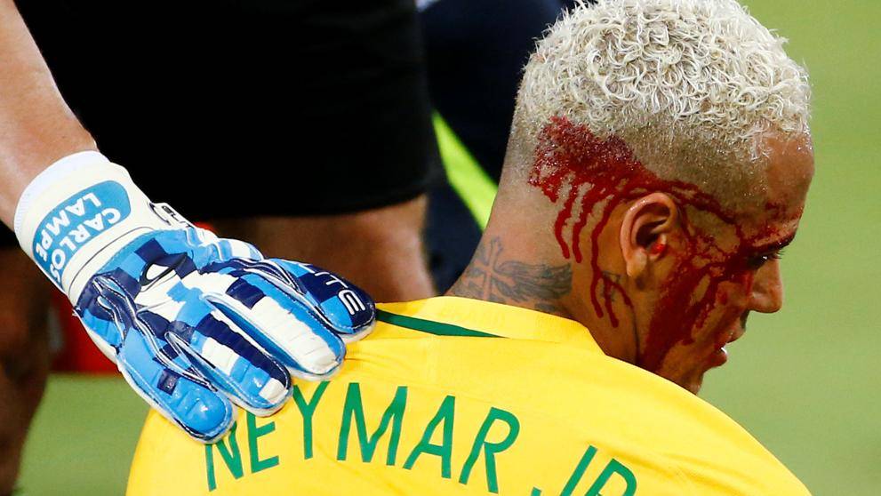 La violencia a Neymar y sus cómplices