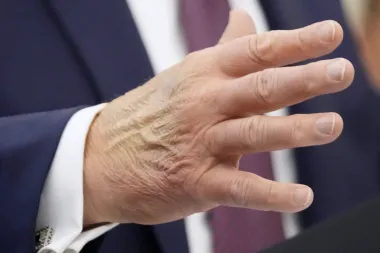 Trump, los rumores de salud y el nuevo villano favorito: la Inteligencia Artificial