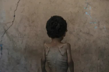 Gaza: Anatomía de una Devastación sin Precedentes