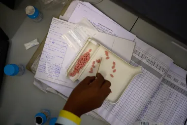 El nuevo rostro de la ayuda sanitaria de EE. UU. en África: ¿interés estratégico o abandono humanitario?