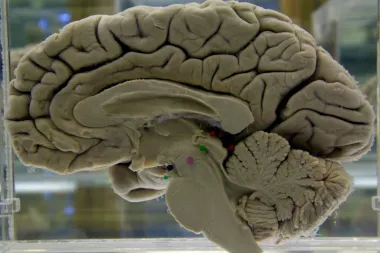 Entrenar la mente: cómo las actividades cognitivas construyen reserva cerebral y retrasan el deterioro